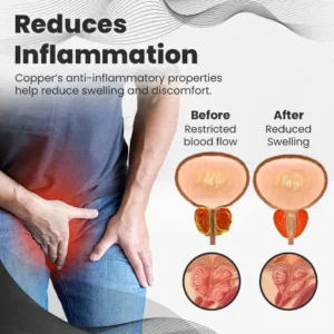 【 ✨Official Brand Store ✨】Seurico™ Copper Mag Prostate Therapy Ring（Limited Time Discount 🔥 Last Day）